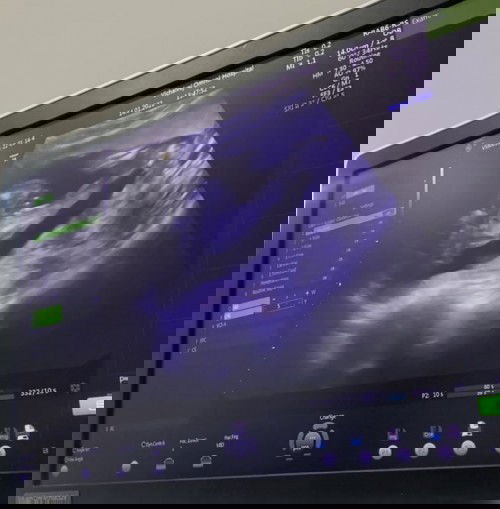 หญิงหรือชายคะแบบนี้ 🙏🏻🙏🏻🙏🏻