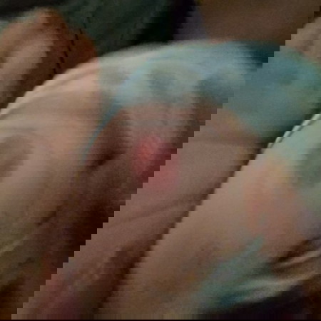 ฉีดวัคซีน bcg แต่ฝีไม่แตก เมื่อไรจะยุบคะ