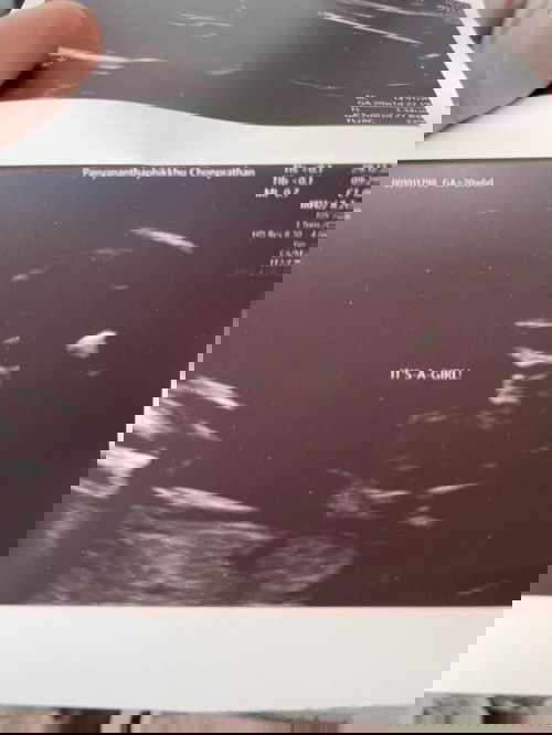 แบบนี้ผญ แน่นอนไหมคะ 
ทำไม ในรูปเป็นแหลมๆ2อัน😂😂