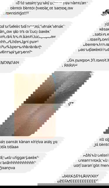 Krim ruam popok bayi, ruam asi atau biang keringet anak.