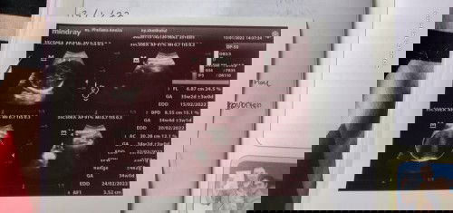 Demam batuk-pilek dikehamilan 36w