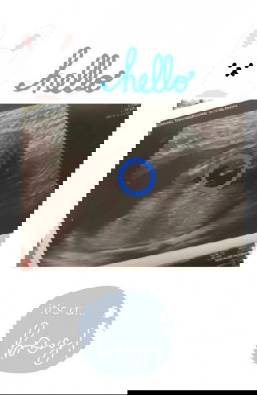 คนแก่แถวบ้านบอกว่า "เพศเด็กมันจะมาเหมือนกันเป็นล็อตๆ" เกิดไล่กัน เพศเดียวกัน??