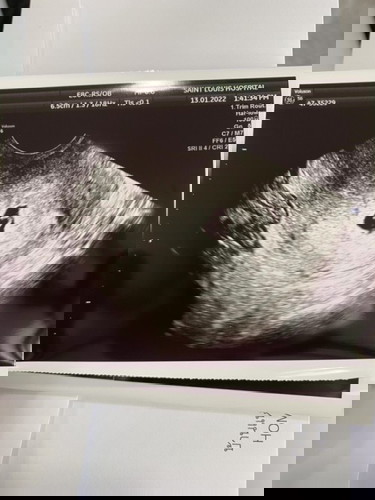 แม่ๆเห็นน้องตอนกี่วีคคะ