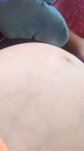 รู้สึกว่าลูกดิ้นน้อยลง😢