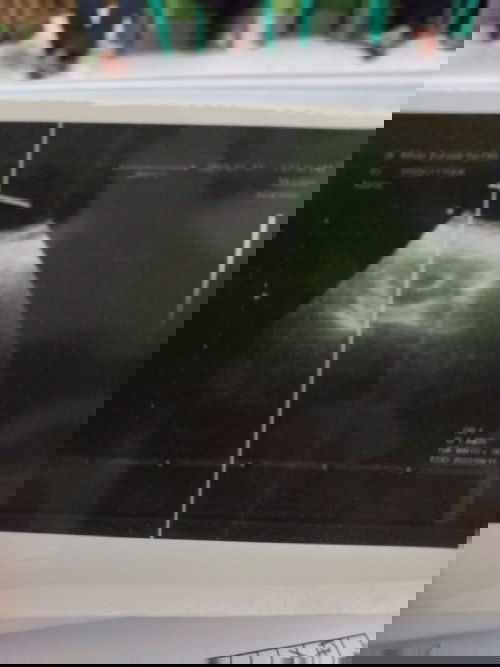 Kehamilan 6-7 minggu