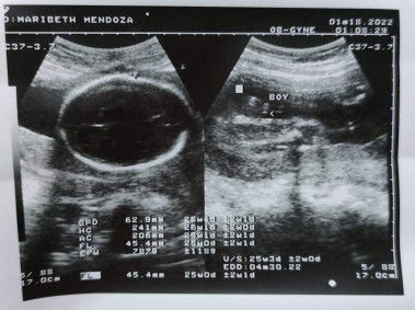 Nag iba gender ni baby