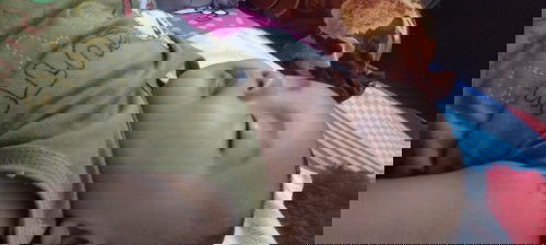 Bercak putih di wajah, usia bayi 7 bulan