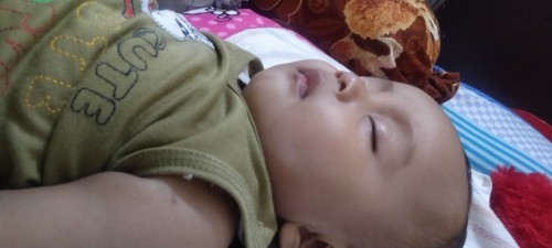 Bercak putih di wajah, usia bayi 7 bulan