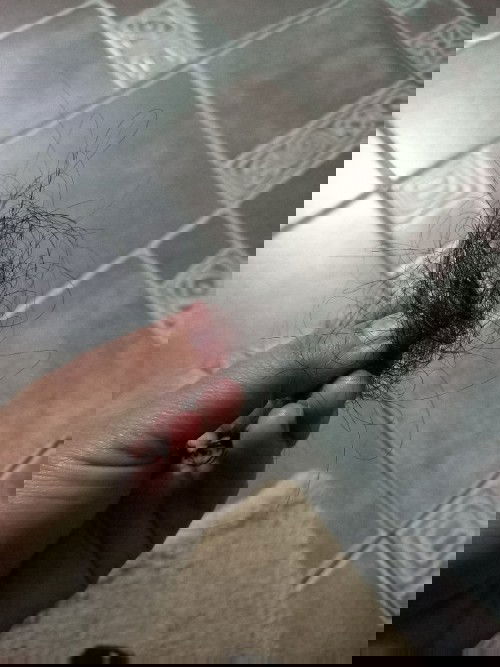 Rambut sangat rontok masa menyusui,?