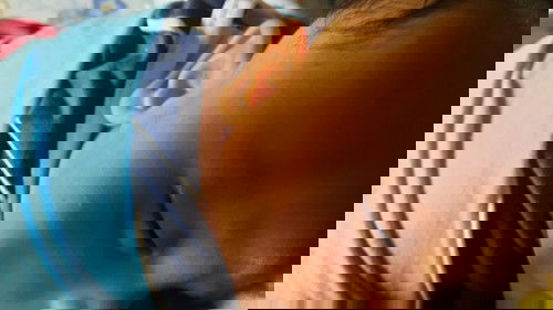 Beruntusan Di Wajah Bayi