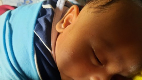 Beruntusan Di Wajah Bayi