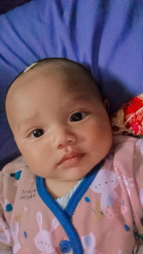 Kenapa ya bayi saya pupnya ngak teratur 3hari sekali dan pupnya hijau pekat.. Atau tidak cocok Sufor