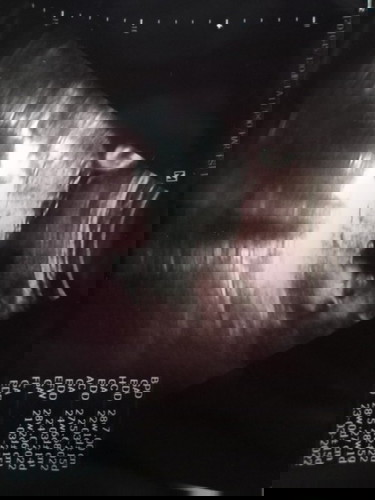 ช่วยดูภาพอัลตร้าซาวด์ให้หน่อยค่ะ