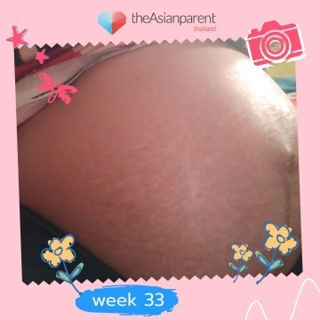 34weekน้องยังไม่กลับหัว
