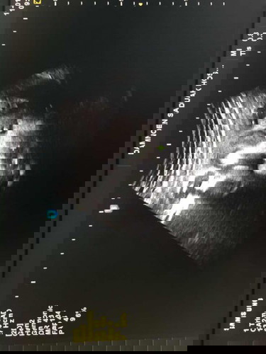 แม่ๆอวดรูปหน้าน้องตอนซาวด์กันหน่อยค่ะ