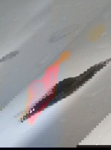 เลือดกำเดาไหล