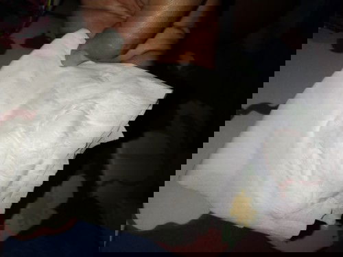 มีน้ำไหล ตกขาว หรือ น้ำคร่ำรั่ว