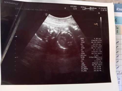 ขออนุญาตค่ะ