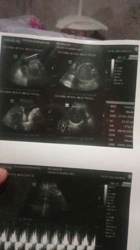 Assalamualaikum Bun. Kira kira ini USG berpa D yah Bun ? Harganya 340