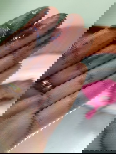 มีมูกเลือดออกคล้ายประจำเดือน