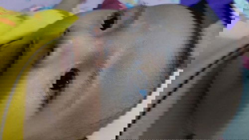 Bercak putih diwajah bayi