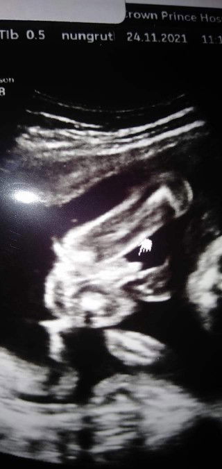 เพศลูก ในภาพเป็นหญิงหรือชายค่ะ