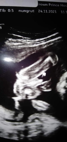 เพศลูก ในภาพเป็นหญิงหรือชายค่ะ