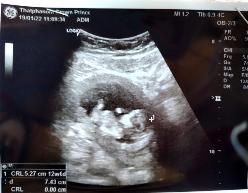 #แม่ท้องแรกค่ะ