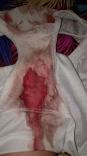 Bunda saya bingung minta pencerahannya dongg!!