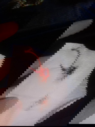 Keluar lendir campur darah