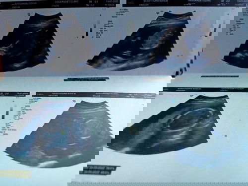 มีใครมาถึงครึ่งทางกันแล้วบ้างคะ