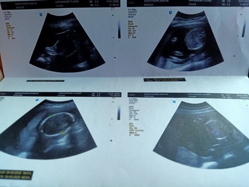 มีใครมาถึงครึ่งทางกันแล้วบ้างคะ