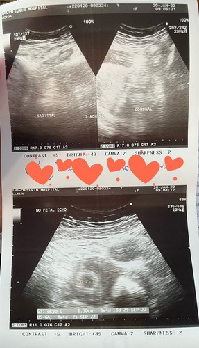 🤰🏻 4 weeks and 4 days. 🤰🏻