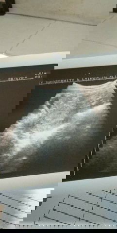 Plss help po mga momshy😢