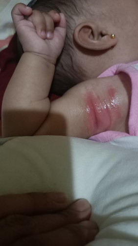 HELP!!! NAMUMULA PO NG SOBRA