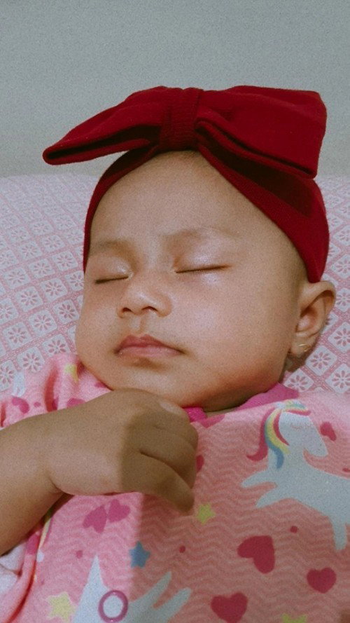 Solusi rambut rontok