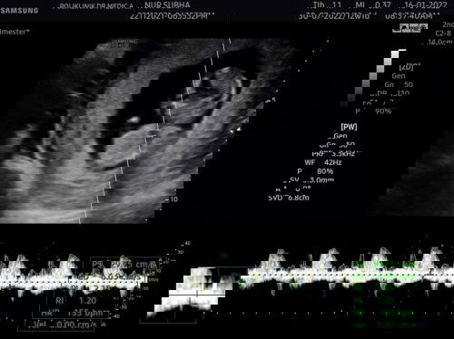 Journey for 12 week baby