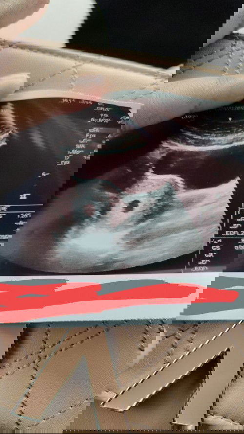 Folid acid & susu untuk ibu mengandung