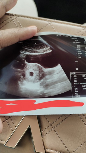 Folid acid & susu untuk ibu mengandung