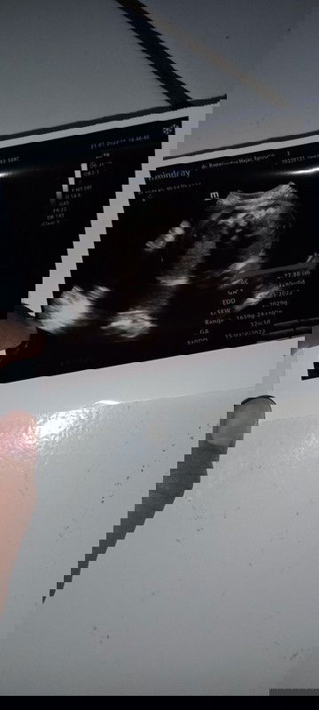 HPL mundur karena BB janin turun