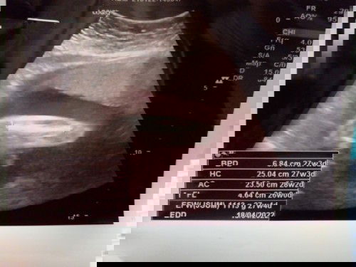 แม่ช่วยดูให้หน่อยค่ะ น้องมีจู๋ใช่ไหมค่ะ