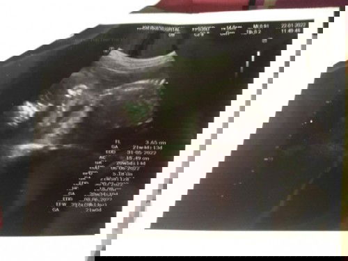 ดูเพศไม่เป็นค่า