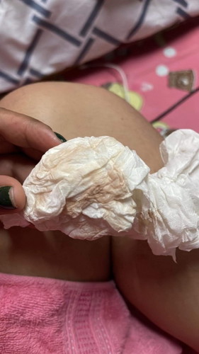 เลือดออกเป็นสีน้ำตาลจางๆ พอจะมีหวังบ้างมั้ยค่ะ 😅😅