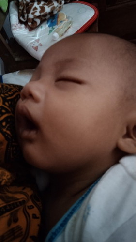 Bingung puting, tersenyum,mengoceh