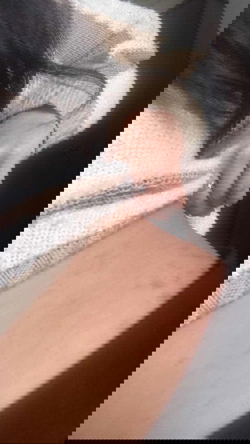 ท้องลายหลังคลอด