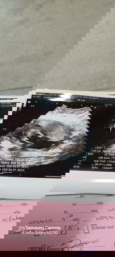 สอบถามแม่ๆหน่อย