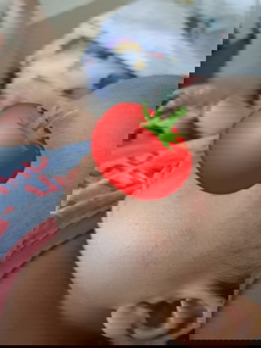 ใช่ผดผื่นหรือเปล่าคะ