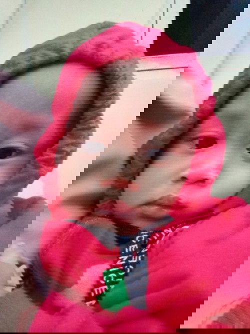 Putih-putih diwajah anak