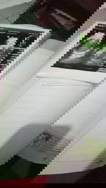 Hamil 37week.posisi masih melintang.