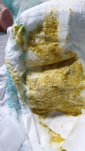 Poo colour
